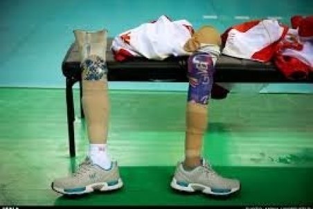 تابع: عجله‌ای برای برگزاری اردوهای پارالمپیکی‌ها نداریم