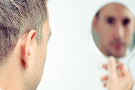 این نشانه‌ها روی صورت شما خبر از کمبود ویتامین می‌دهند