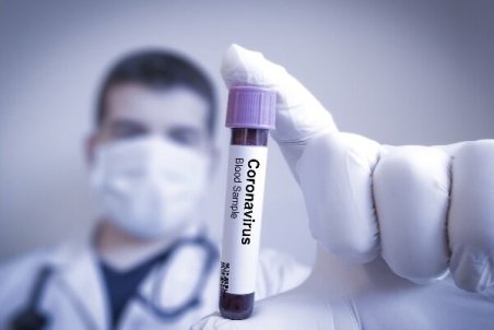 بستری بودن ۷۰۰ بیمار کرونایی/ وضعیت ۱۵۰ نفر وخیم است