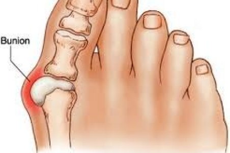 چه شستی کج می‌شود؟