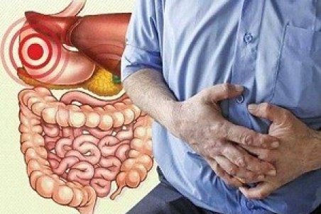 آنچه باید از نفخ شکم و راه‌های درمان آن بدانید