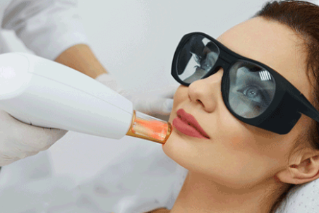 لیزر اربیوم چیست و در چه مواردی کاربرد دارد؟