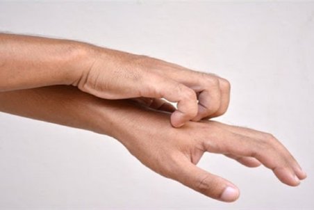 خارش پوست، جدیدترین نشانه ابتلا به ویروس کرونا