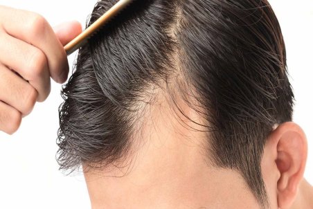 برای خلاصی از خشکی مو چه کنیم؟