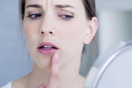 درمان تبخال؛ این مهمان ناخوانده