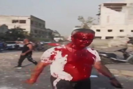 فیلمی دلخراش از زخمی‌های انفجار وحشتناک بندر بیروت