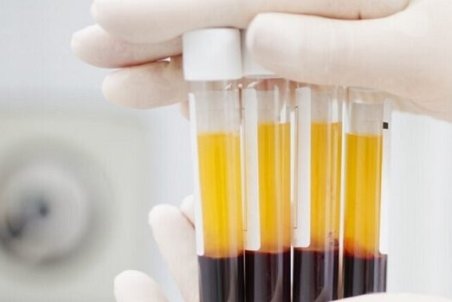 ذخیره پلاسما در اصفهان به صفر رسید