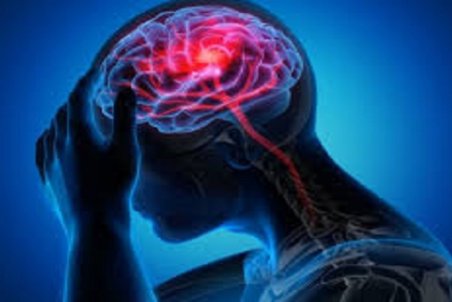 بایدها و نبایدهای تغذیه‌ای برای آن‌ها که میگرن دارند/ راهکاری مفید برای درمان میگرن