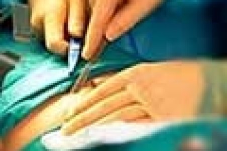 انجام سالانه ۳۰هزار جراحی زیبایی در ایران