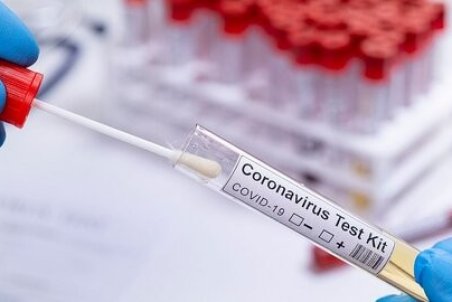 تست جدید کرونا مانع شیوع بیشتر بیماری می‌شود!