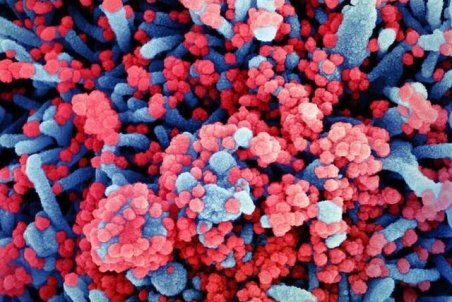 مردم بی‌جهت CT نکنند/شاید برای همیشه کرونا با ما باشد/تعریق فراوان جزء علائم کروناست