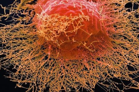 ابتلا به کرونا و آنفلوانزا را چگونه از یکدیگر تشخیص دهیم؟