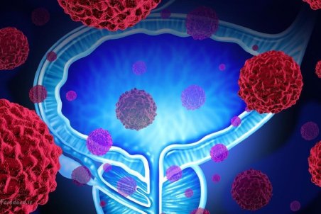 کرونا سبب نارسایی کلیه می‌شود