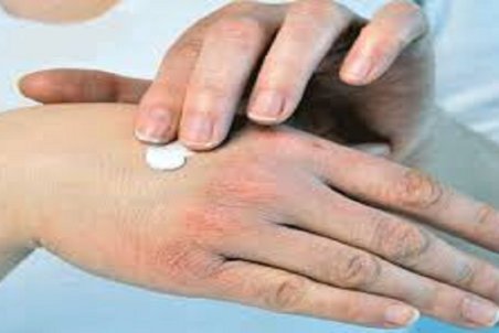 روش‌های ساده برای جلوگیری از خشکی پوست