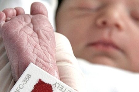 این بیماری نوزادان را "عقب مانده" می‌کند!
