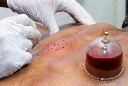 غلظت خون چگونه می‌تواند تهدیدی برای سلامت باشد؟