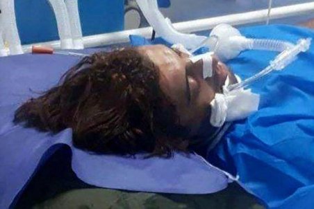 (عکس) مدافع سابق تراکتور به کما رفت