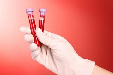 نشانه‌های خاموش سرطان روده بزرگ