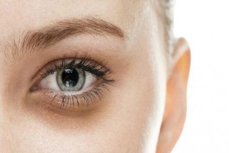 چند راهکار طبیعی برای برطرف کردن تیرگی دور چشم