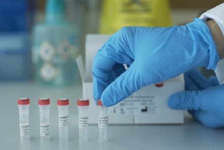 شناسایی 23 جهش ویروس کرونا در ایران