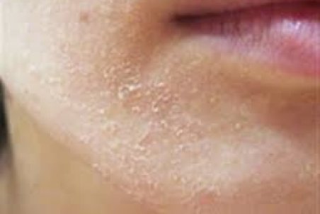 ۵ خوردنی مفید برای رفع خشکی پوست