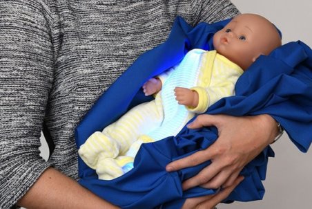 زردی کودکان را چگونه درمان کنیم؟