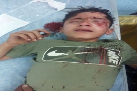 مانی را برای ادامه درمان به تهران منتقل کردند/ مادر مانی: نمی‌خواهم در این شرایط حرف بزنم