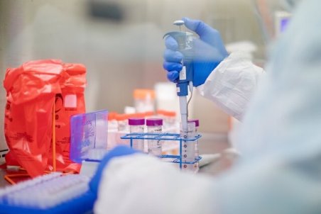 شرکت‌های دانش‌بنیان ساخت "آنزیم"‌های کیت‌های تشخیص کرونا را آغاز کرده‌اند