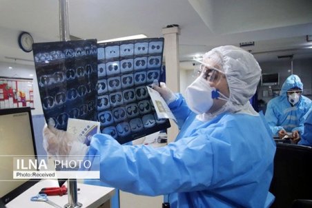 افزایش ۲۵۰ درصدی انجام سی‌تی‌اسکن ریه در بیمارستان‌های دانشگاه‌های علوم پزشکی ۹ استان