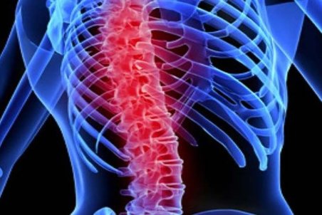 عادت‌های نادرستی که به ستون فقرات افراد آسیب می‌زند + فیلم