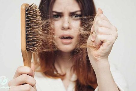 طاسی مردانه؛ همیشه هم ژنتیک مقصر نیست