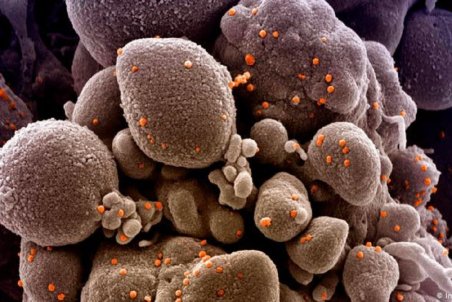 ۸۰ درصد مبتلایان به کرونا نیاز به بستری ندارند