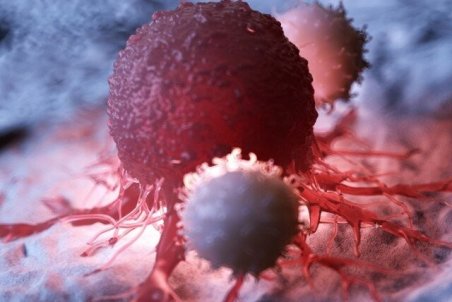 نشانه‌های سرطان پستان/ سهم یک درصدی مردان در میان مبتلایان