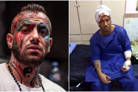 شایعه فوت امیر تتلو؛ ماجرا چیست؟