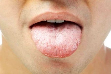 دلایل تلخی دهان را بشناسید