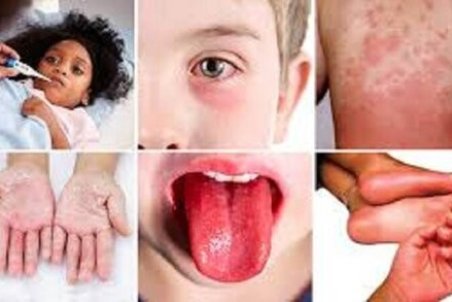 وحشت آورترین علامت ابتلا به کرونا در کودکان و بزرگسالان