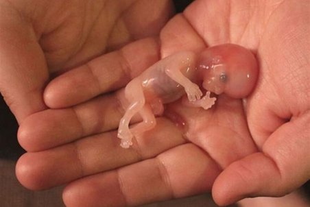 "سقط جنین" ۳۲ برابر بیشتر از کرونا منجر به مرگ شده است!