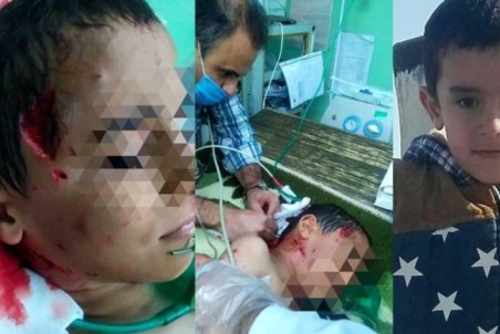 ۳۴ کودک، زن و مرد طعمه سگ‌های خیابانی