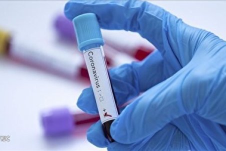 رکوردی جدید در تاریخ مرگ‌های کرونایی البرز