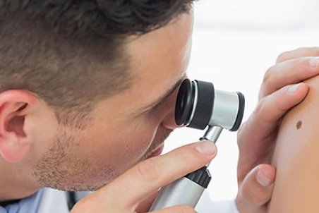 علایم سرطان پوست،پیشگیری و درمان سرطان پوست به همراه عکس