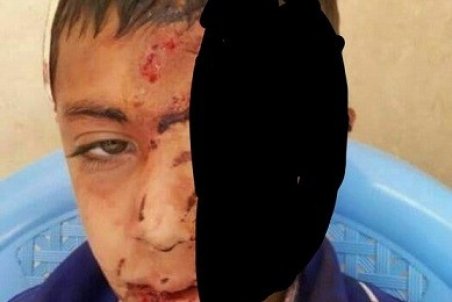 سقوط دانش آموز از کوه به خاطر شبکه شاد؟/ آموزش و پرورش: برای چیدن گل زعفران رفته بود!