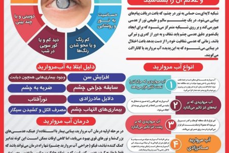 علایم و راه‌های درمان «آب مروارید»