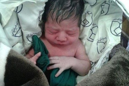 هشدار وزارت بهداشت درمورد افزایش تولدهای تقویمی سزارینی