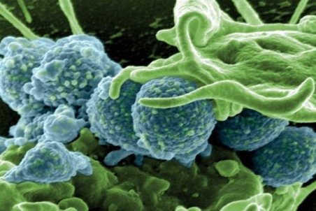 علائم مارسا؛ بیماری شبیه به کرونا + راه های درمان