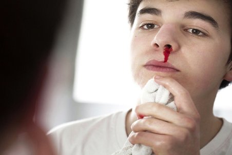 خون دماغ از شایع ترین بیماری های پاییز و زمستان