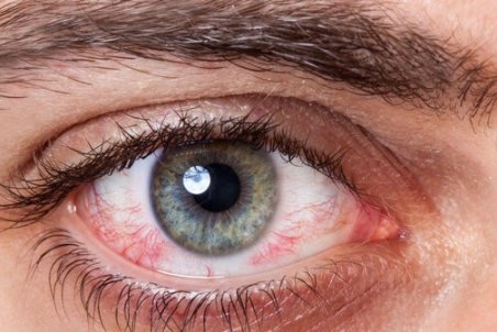 توصیه هایی برای سلامت چشم ها