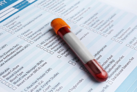 آزمایش خون چه چیزهایی را نشان می دهد؟