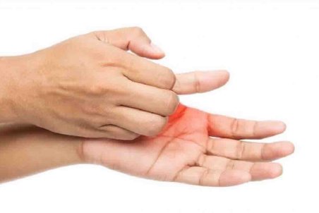 خارش کف دست نشانه پول‌دار شدن است؟