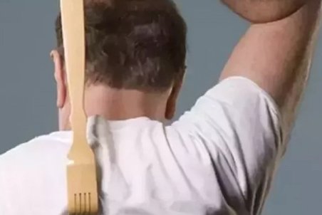 خارش مداوم پشت نشانه چیست؟