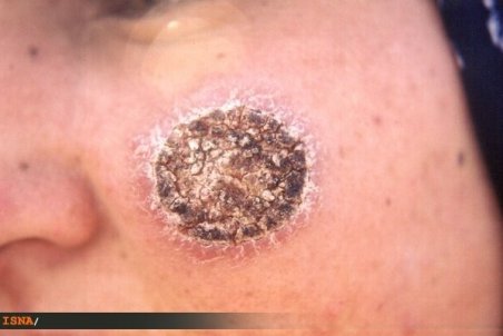 سالک؛ زخمی به عمق یک عمر